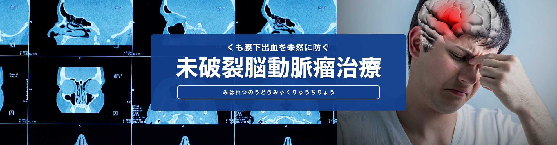 くも膜下出血を未然に防ぐ 未破裂脳動脈瘤治療